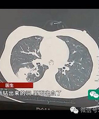 "较真 | 小龙虾浑身都是寄生虫不能吃?错"