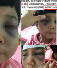 女孩被奶奶打成这样!还在垃圾桶里找东西吃…