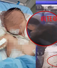 人渣!医生儿子被患者疯狂砍伤 孩子才十岁!