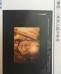 ͶƱ�ˣ�ͶƱ�ˣ����ڼ���19¥�ٷ�΢����ظ�55��