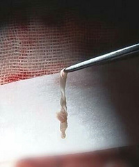 ��ͯ�������ˮ �Դ���7.5���׼��������沿�鴤