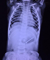 һ��С����ˣ��5���������̽�����..