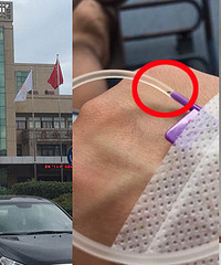 萧山瓜沥第二人民医院挂盐水挂出不明黑点!