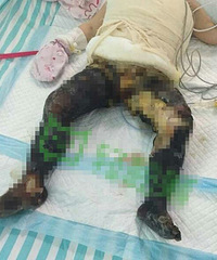 Ůͯ˫�ȿ���Ƥ��ը�� ����������ȴ...