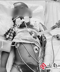 3�꺢���������Ű�� ������Σ�ѽ���֢�໤��