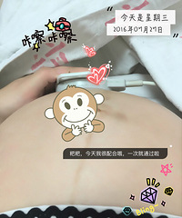 "胎心监护做起来"
