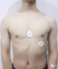 "生完宝宝后乳房下垂,难看的不行。。"