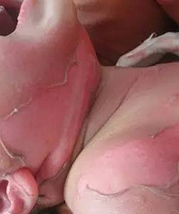 һ�걦��ȫ���������Լ15%��ҽ����Ӧ����ʩÿһ��������