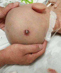 �ۣ�һö������������1�걦���ĺ����ף�