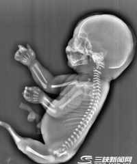 ���ģ��������軳�������㱦����