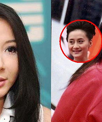 老得好可怕 整容打针真不能随便来...