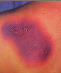 ��������к��󱳳�����Ƭ�ڰߣ���Ȼ��ҩ����ģ�