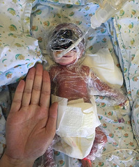 Ů�����°��ƴ�С˫��̥ ���ֵ����ز���1����