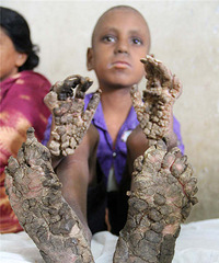 7����ͯ�������˲��� �ֽ�������֦����