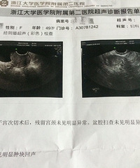 在浙二医院差点被吓破胆