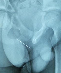 10���к���������������� ȡ����ʱ�Ѿ�����