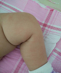 �����ơ��ǲ���ʪ���Ҫ������