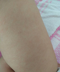 �����ơ��ǲ���ʪ���Ҫ������