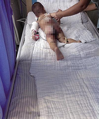 1����ͯ�������̲����� �ض����˻�Ӱ�췢��