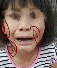 Ů������Χ����������  �����ˣ���ץ�˲���ҧ��