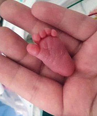 ���ؽ�0.4���ʵ��Ĵָ���