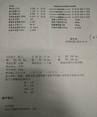 �����ơ��궯��S/Dָ����������