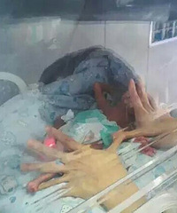 16����Ů����2�ﱦ�� �ֱ�ֻ�г���Ĵָ�ַ�