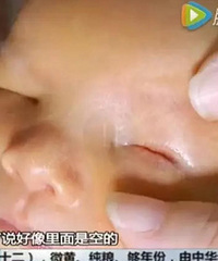 "广州女子产子后崩溃:宝宝根本没眼睛"