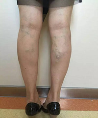 ��С�Ȳ����������������