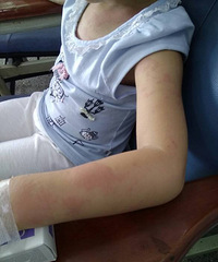 ��������5����Ī������ȫ��������� ����ҽ��Ҳ������