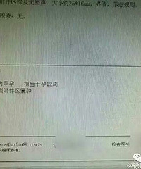 12��Ů����ҽԺ������ ҽ�����������ྐྵ��...