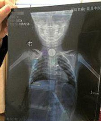 3��Ůͯ����Ӳ�ҿ���������ǿ������Ū�ú���ʳ��