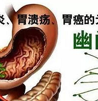 吹一口气,就知有否胃癌风险!幽门螺旋杆菌测定名额免费送!