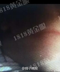 ���ʸ��������ı����������� ҽԺ���ͣ������Ƥ̫����