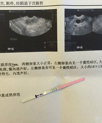"不敢相信,测到了!!内膜薄,卵泡小,真没想到,一定要传好孕"