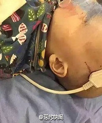 【亲子观点pk】孩子在家就安全?潜在危险知道多少