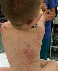 5����ͯ���Լ�������ɻ��� ̩�Ͽ�о�����