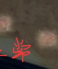 "爱吃鸭脖易患淋巴癌?你一定不知道鸭子的淋巴结在哪里吧"