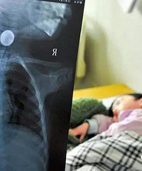 �����22���´�ı�������Ӳ�ҿ���ʳ��...