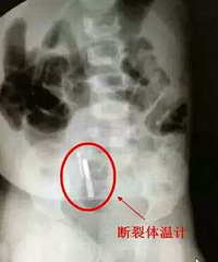 һ���׶������а�����¼� ԭ����...