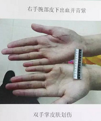 ���˷�ָ���ö�������ʩ��Ű�� �úݵļ�ĸ