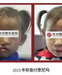"最美微笑 让爱延续 ——第七届唇腭裂大型公益救助活动"