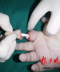 8�걦���������ϴ�»� ����ʳָ�������ʶ�...