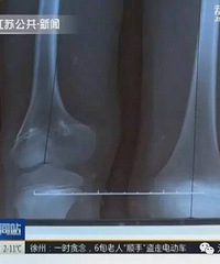 �к������� ��ĸ����ȥ�Ϲ�����8CM��