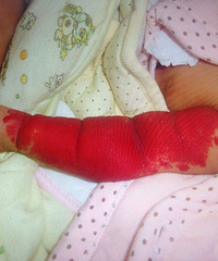 ���ģ��ճ����ı��� һֻ�ֱ۾�Ȼ�Ǻ�ɫ��...