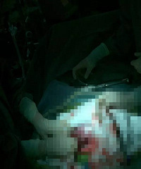 "我亲眼见证了一场惊心动魄的剖腹产手术!为了生孩子,妈妈有多"