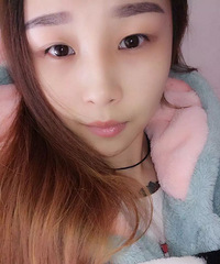 卤煮从小就是不明显的双眼皮 终于存钱解救了寄己