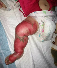 8�´�Ůͯ���ȴ�������죬Ƥ�����䣡ԭ����...