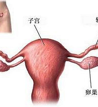 "输卵管堵塞怎么治 有什么症状 如何治疗 如何预防"