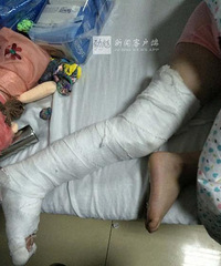 �ң�5��Ůͯ���ĸ���Ű�� 9���߹ǹ��ۣ�